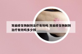 蕁麻疹生物制劑治療有效嗎 蕁麻疹生物制劑治療有效嗎多少錢