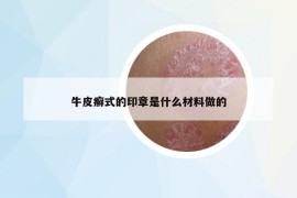 牛皮癬式的印章是什么材料做的