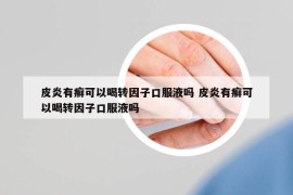皮炎有癬可以喝轉(zhuǎn)因子口服液嗎 皮炎有癬可以喝轉(zhuǎn)因子口服液嗎
