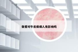 做愛對牛皮癬病人有影響嗎