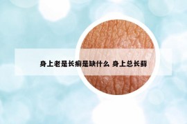身上老是長癬是缺什么 身上總長蘚