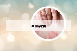 牛皮癬歌曲