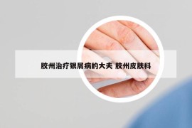 膠州治療銀屑病的大夫 膠州皮膚科