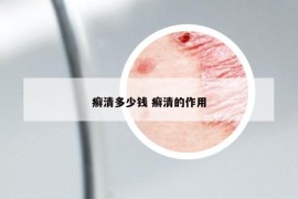 癬清多少錢 癬清的作用