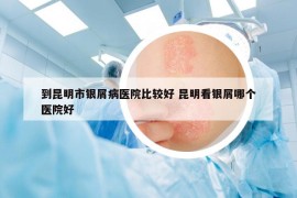 到昆明市銀屑病醫(yī)院比較好 昆明看銀屑哪個醫(yī)院好