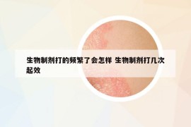 生物制劑打的頻繁了會(huì)怎樣 生物制劑打幾次起效