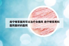 南寧哪家醫(yī)院可以治療白癜風 南寧哪家男科醫(yī)院最好的醫(yī)院