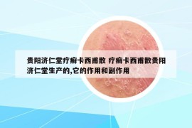 貴陽(yáng)濟(jì)仁堂療癬卡西甫散 療癬卡西甫散貴陽(yáng)濟(jì)仁堂生產(chǎn)的,它的作用和副作用