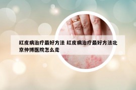 紅皮病治療最好方法 紅皮病治療最好方法北京仲博醫(yī)院怎么走