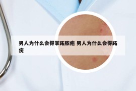 男人為什么會得掌跖膿皰 男人為什么會得跖疣