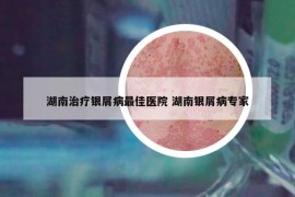 湖南治療銀屑病最佳醫(yī)院 湖南銀屑病專家