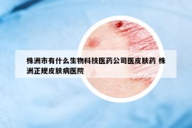 株洲市有什么生物科技醫(yī)藥公司醫(yī)皮膚藥 株洲正規(guī)皮膚病醫(yī)院