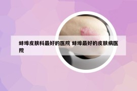 蚌埠皮膚科最好的醫(yī)院 蚌埠最好的皮膚病醫(yī)院