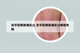 關(guān)節(jié)型銀屑病忌口 關(guān)節(jié)型銀屑病忌口哪些食物