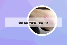 激素影響牛皮癬不能吃什么