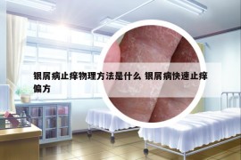 銀屑病止癢物理方法是什么 銀屑病快速止癢偏方