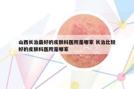山西長(zhǎng)治最好的皮膚科醫(yī)院是哪家 長(zhǎng)治比較好的皮膚科醫(yī)院是哪家