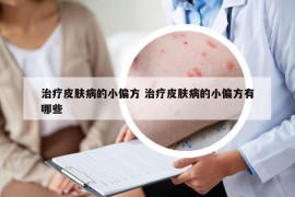 治療皮膚病的小偏方 治療皮膚病的小偏方有哪些
