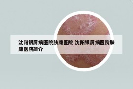 沈陽銀屑病醫(yī)院膚康醫(yī)院 沈陽銀屑病醫(yī)院膚康醫(yī)院簡介