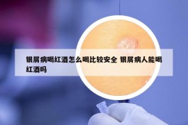 銀屑病喝紅酒怎么喝比較安全 銀屑病人能喝紅酒嗎