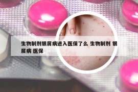 生物制劑銀屑病進入醫(yī)保了么 生物制劑 銀屑病 醫(yī)保
