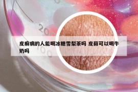 皮癬病的人能喝冰糖雪梨茶嗎 皮蘚可以喝牛奶嗎