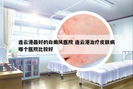 連云港最好的白癜風(fēng)醫(yī)院 連云港治療皮膚病哪個(gè)醫(yī)院比較好