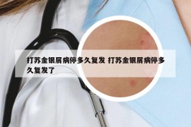 打蘇金銀屑病停多久復(fù)發(fā) 打蘇金銀屑病停多久復(fù)發(fā)了