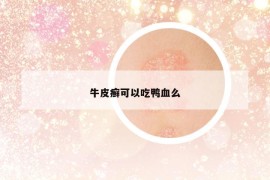 牛皮癬可以吃鴨血么