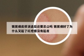 銀屑病皮疹消退后還要忌口嗎 銀屑病好了為什么又起了紅疙瘩沒有起皮