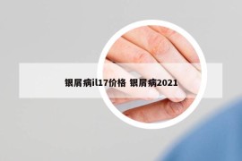 銀屑病il17價(jià)格 銀屑病2021