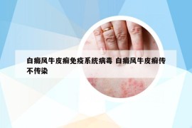 白癜風(fēng)牛皮癬免疫系統(tǒng)病毒 白癜風(fēng)牛皮癬傳不傳染