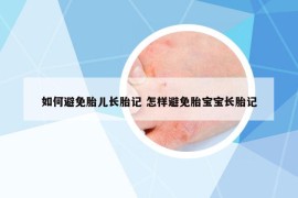 如何避免胎兒長胎記 怎樣避免胎寶寶長胎記