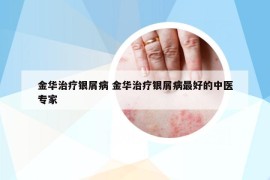 金華治療銀屑病 金華治療銀屑病最好的中醫(yī)專家
