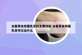 冰蠶草本抑菌乳膏的主要功效 冰蠶草本抑菌乳膏可以治什么