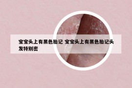寶寶頭上有黑色胎記 寶寶頭上有黑色胎記頭發(fā)特別密
