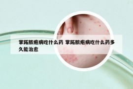 掌跖膿皰病吃什么藥 掌跖膿皰病吃什么藥多久能治愈