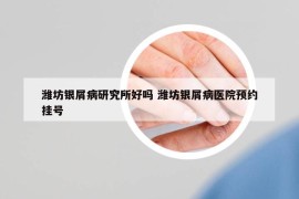 濰坊銀屑病研究所好嗎 濰坊銀屑病醫(yī)院預(yù)約掛號
