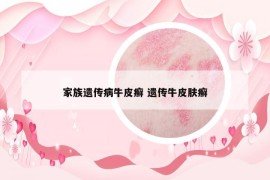 家族遺傳病牛皮癬 遺傳牛皮膚癬