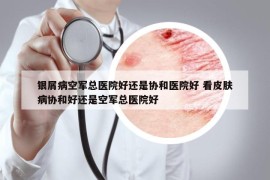 銀屑病空軍總醫(yī)院好還是協(xié)和醫(yī)院好 看皮膚病協(xié)和好還是空軍總醫(yī)院好