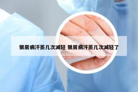 銀屑病汗蒸幾次減輕 銀屑病汗蒸幾次減輕了