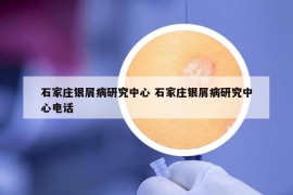 石家莊銀屑病研究中心 石家莊銀屑病研究中心電話
