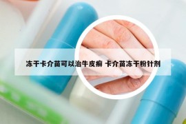 凍干卡介苗可以治牛皮癬 卡介苗凍干粉針劑