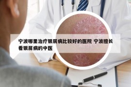 寧波哪里治療銀屑病比較好的醫(yī)院 寧波擅長看銀屑病的中醫(yī)