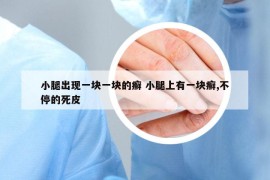 小腿出現(xiàn)一塊一塊的癬 小腿上有一塊癬,不停的死皮