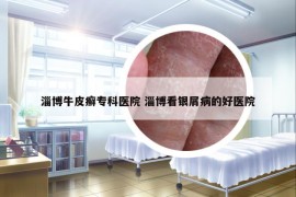 淄博牛皮癬專(zhuān)科醫(yī)院 淄博看銀屑病的好醫(yī)院