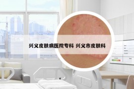 興義皮膚病醫(yī)院?？?興義市皮膚科