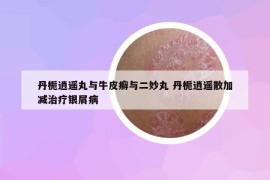 丹梔逍遙丸與牛皮癬與二妙丸 丹梔逍遙散加減治療銀屑病