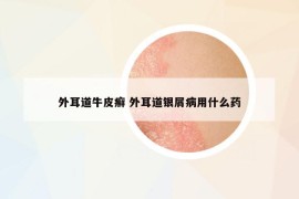 外耳道牛皮癬 外耳道銀屑病用什么藥