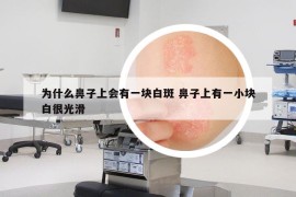 為什么鼻子上會有一塊白斑 鼻子上有一小塊白很光滑